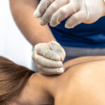 Acupunctura